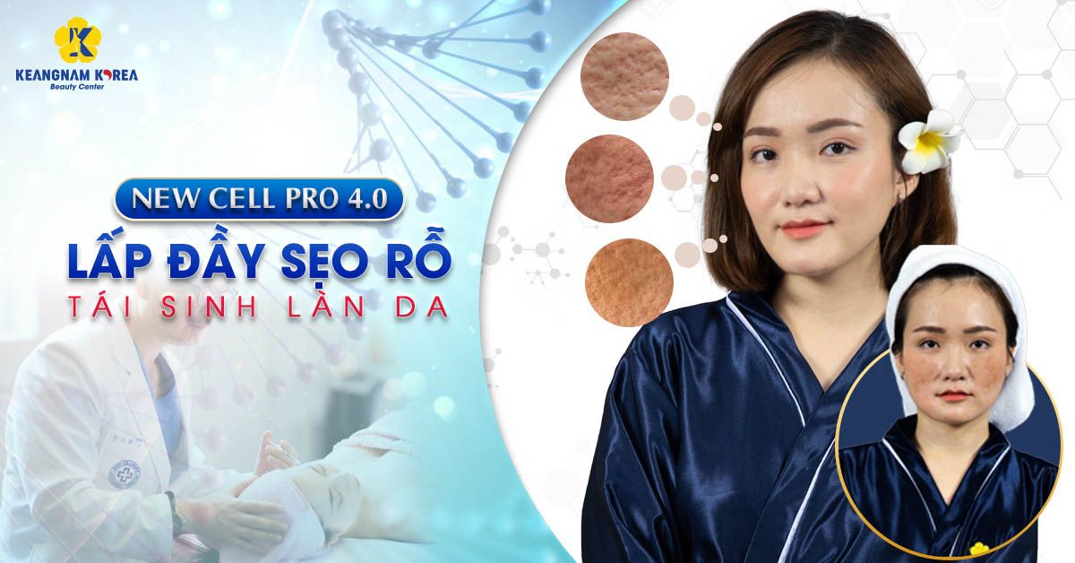 tri seo ro cong nghe new cell