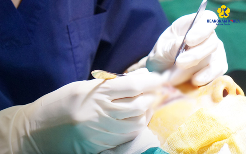 Top-Tier Blepharoplasty Revision in Ho Chi Minh City: Reclaiming Confidence at Keangnam Korea 6 Blepharoplasty Revision