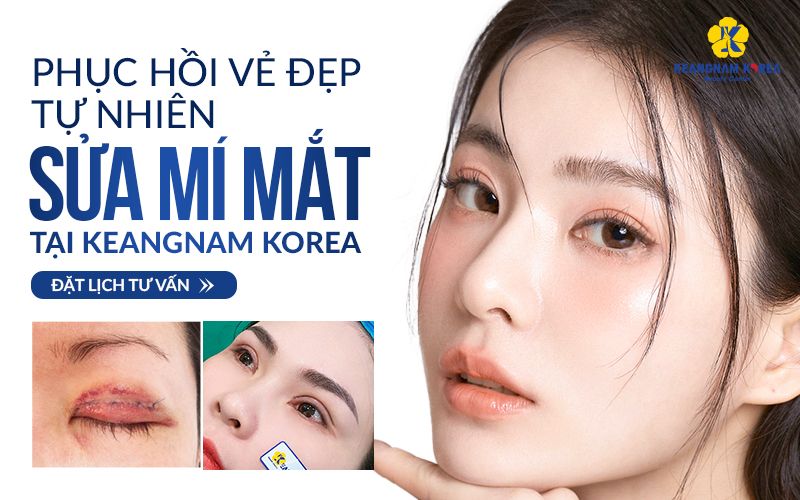 Sửa mí mắt tại Keangnam Korea