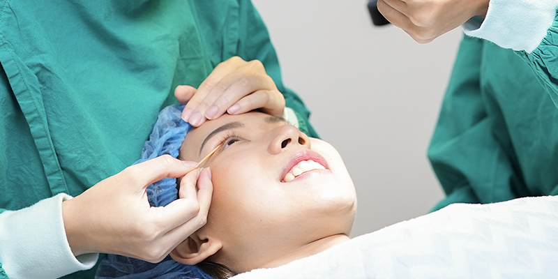 Double Eyelid Surgery: What It Is, Should You Get It, and the best eyelid clinic in Ho Chi Minh City 5 Double Eyelid Surgery