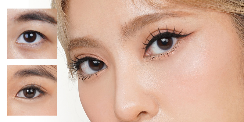 Eyelid Surgery Recovery Time Abroad: How Soon Can You Fly? 1 Eyelid Surgery Recovery Time Abroad