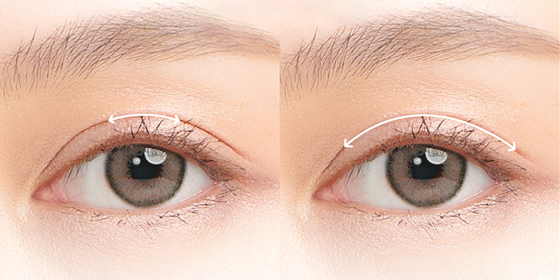 Eyelid Surgery Cost in Ho Chi Minh: The Ultimate Guide to 9 Blepharoplasty Procedures and Their Prices 3 Eyelid Surgery vs. Non-Surgical Blepharoplasty