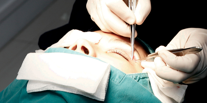 When Should You Consider Eyelid Tightening? Complete 2026 Surgery Cost Guide 2 When Should You Consider an Eyelid Tightening Treatment?