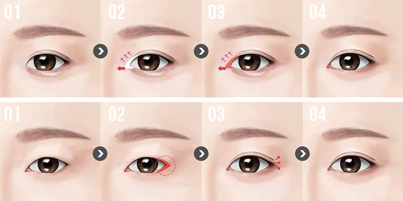What Is Inner and Outer Corner Eye Surgery? Techniques, Costs, and Recovery 2 inner and outer corner eye surgery