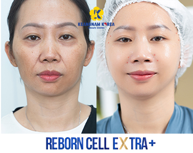 4- Reborn Cell Extra +