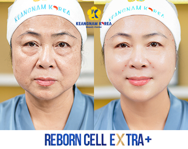 5- Reborn Cell Extra +