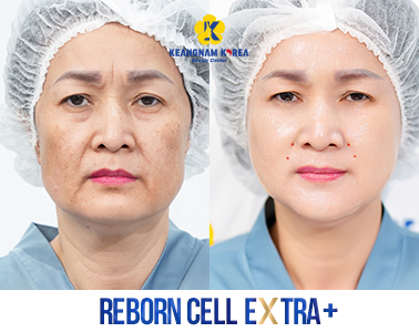6- Reborn Cell Extra +