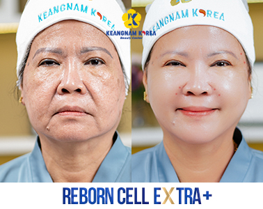 8- Reborn Cell Extra +