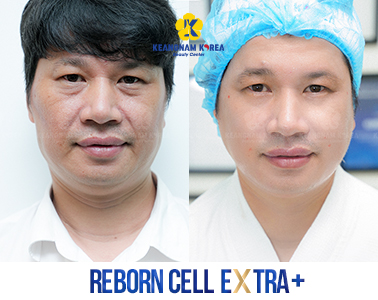 10- Reborn Cell Extra +