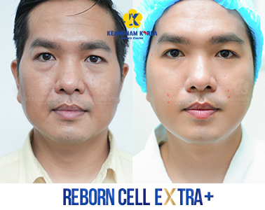 11- Reborn Cell Extra +