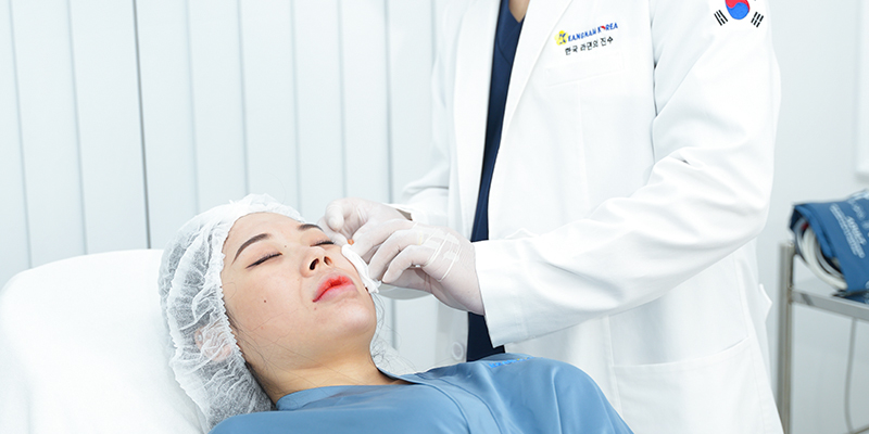 công nghệ căng da mặt không phẫu thuật