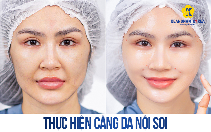 How Much Does Facelift Cost In Vietnam? 2026 Price List And Guide 5 Facelift Cost In Vietnam 2026