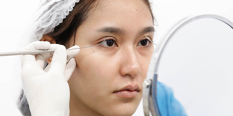 Under-Eye Fat Repositioning in Ho Chi Minh: Are You a Candidate? 2026 Guide 2 What Does Under-Eye Fat Repositioning Do