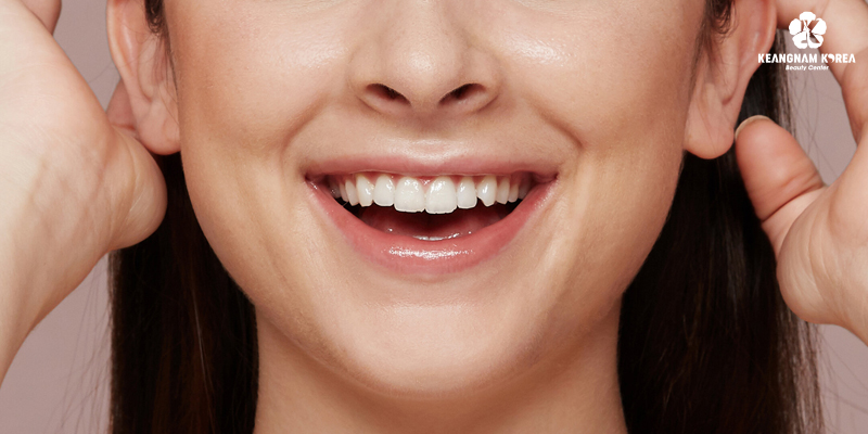 Smile Lines Treatment Cost in Ho Chi Minh: 2026 Price Guide for Deep Smile Lines and Mouth Wrinkles 1 Smile Lines Treatment Cost in Ho Chi Minh