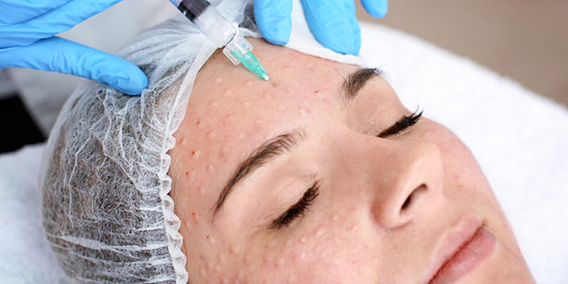 Mesotherapy for Melasma in Ho Chi Minh City: Cost, Sessions Needed & Why Choose Keangnam Korea 2 Mesotherapy for Melasma in Ho Chi Minh City