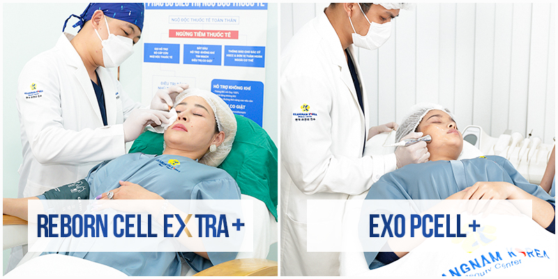 So sánh 2 phương pháp điều trị nám da mặt tại Keangnam Korea
