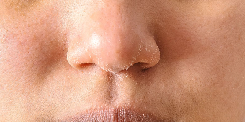 3 cách làm căng bóng da mặt tại nhà cho làn da khô  