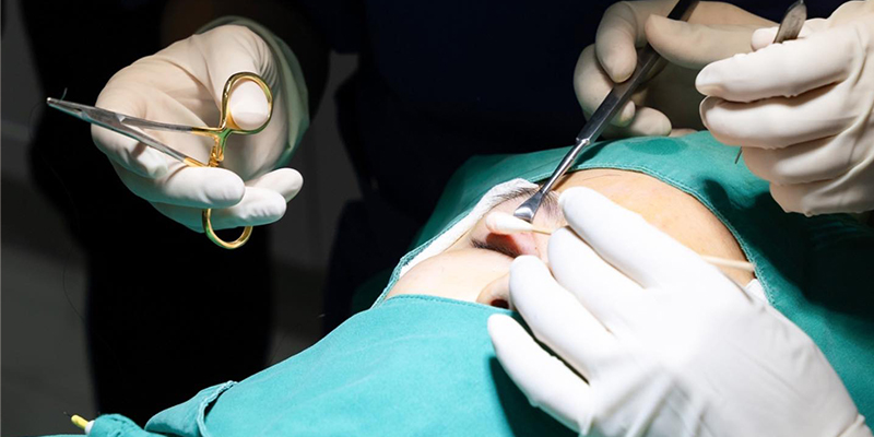 Best Clinic for Eyelid Surgery in Vietnam: The 2026 Guide to Choosing Safely 2 best clinic eyelid surgery vietnam