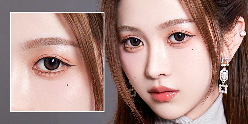 5 Types of Blepharoplasty in Vietnam: The A-Z Guide to Eye Rejuvenation Surgery 1 5 Types of Blepharoplasty in Vietnam