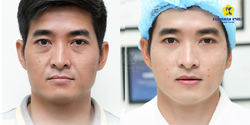 Men’s Skin Treatments & Prices in Ho Chi Minh City 2026 3 Men’s Skin Treatments