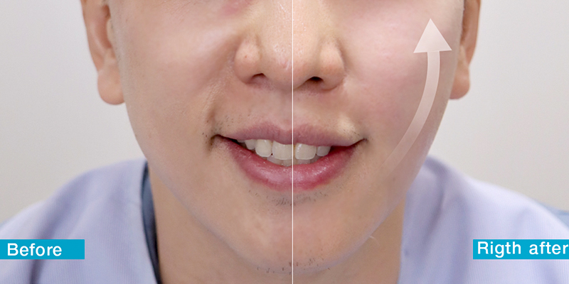 Men’s Skin Treatments & Prices in Ho Chi Minh City 2026 1 Men’s Skin Treatments