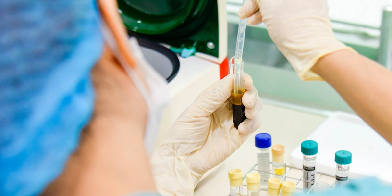 PRP Injection for Glowing Skin: Is It Worth It & How Long Do Results Last? 3 Is PRP Therapy for the Face Safe