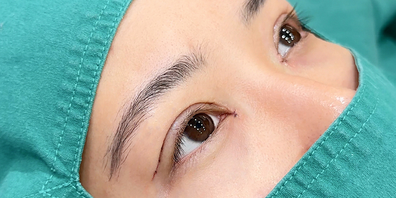 How to Get Bigger Eyes Permanently? 3 surgery for bigger eyes options and cost 2 surgery for bigger eyes