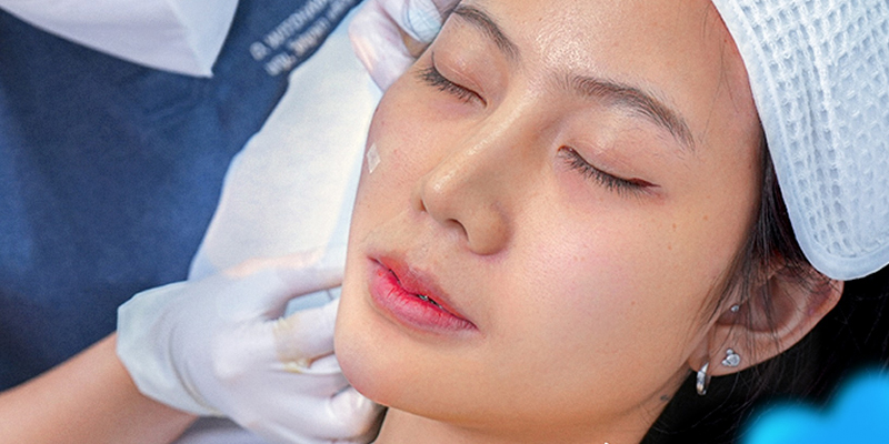 PRP vs. Mesotherapy Skin: Which Skin Rejuvenation Is Better? 4 PRP vs. Mesotherapy Skin