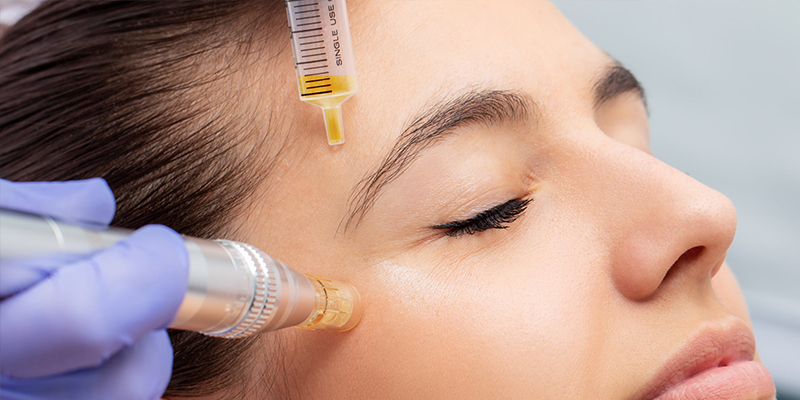PRP vs. Mesotherapy Skin: Which Skin Rejuvenation Is Better? 2 PRP vs. Mesotherapy Skin