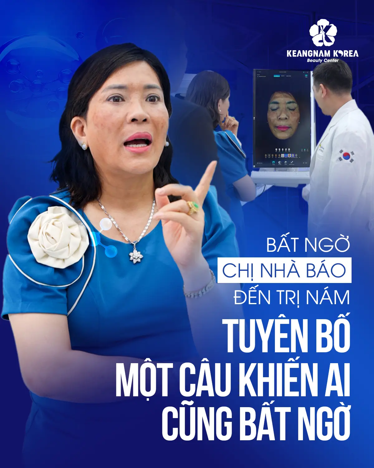 Chị nhà báo điều trị nám