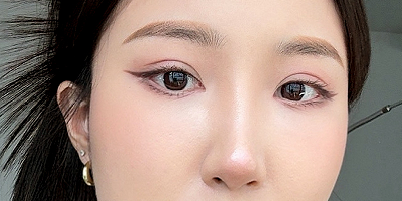 Lateral Canthoplasty for Slanted Eyes: Is It Worth It & Where to Get It Done in Ho Chi Minh City, Vietnam? 1 lateral canthoplasty