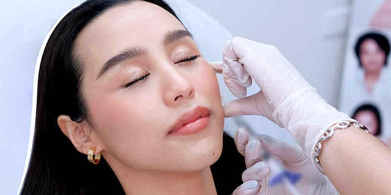 Tiêm filler căng da mặt có tốt không