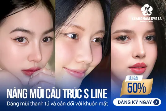 Nâng mũi cấu trúc S Line