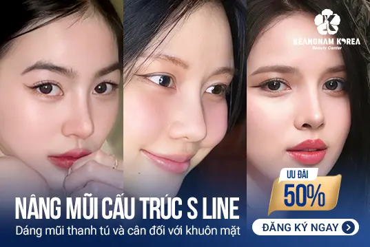 Nâng mũi cấu trúc S Line