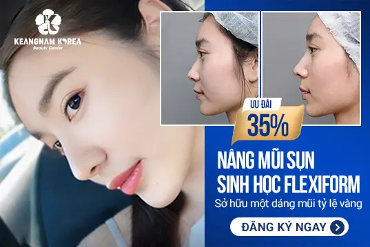 Nâng mũi sụn sinh học FlexiForm