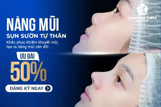 Nâng mũi sụn tự thân