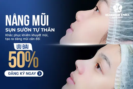 Nâng mũi sụn tự thân