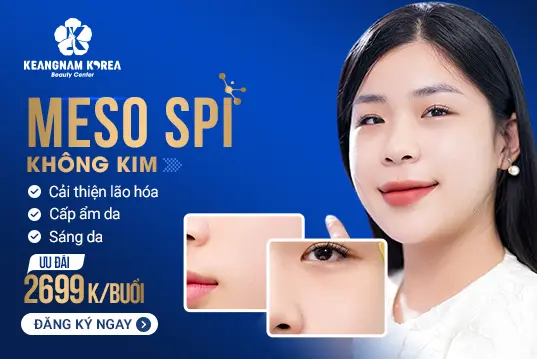 Meso SPI không kim sử dụng meso không kim