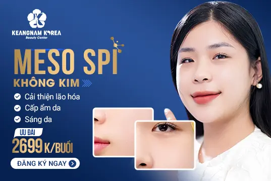 Meso SPI không kim