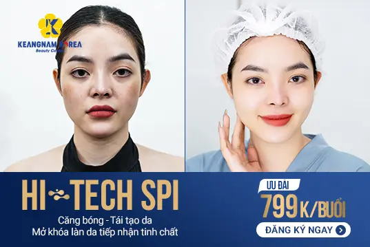 Đẹp da chuyên sâu HI-Tech SPI