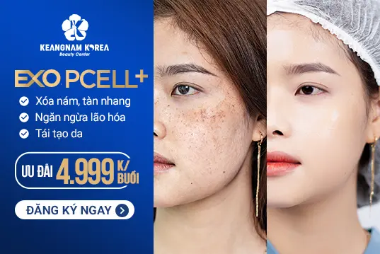 Xoá Bỏ Nám EXO PCELL+