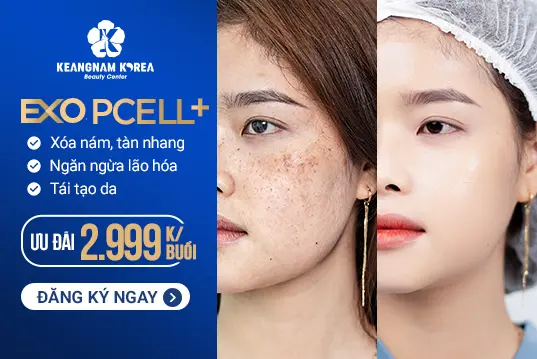 Xoá Bỏ Nám EXO PCELL+