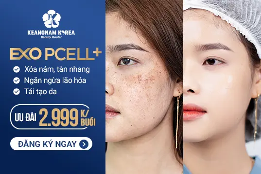 Xoá Bỏ Nám EXO PCELL+