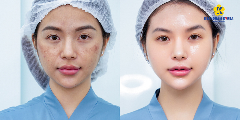 Aesthetic Clinics in Ho Chi Minh City: Services, Costs, and How to Choose One 3 Aesthetic Clinics in Ho Chi Minh City