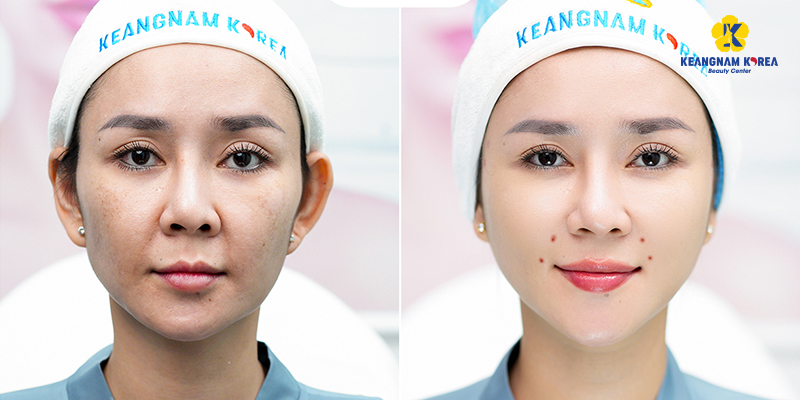 Aesthetic Clinics in Ho Chi Minh City: Services, Costs, and How to Choose One 2 Aesthetic Clinics in Ho Chi Minh City