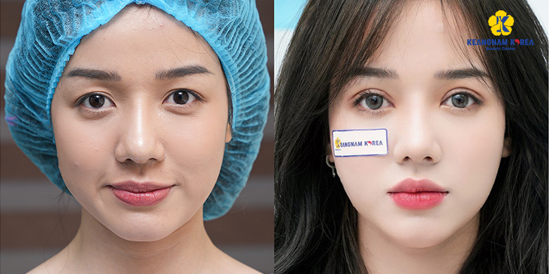 Aesthetic Clinics in Ho Chi Minh City: Services, Costs, and How to Choose One 4 Aesthetic Clinics in Ho Chi Minh City