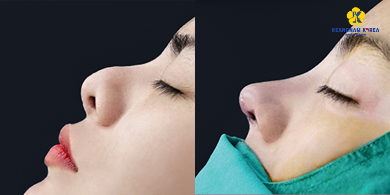 Aesthetic Clinics in Ho Chi Minh City: Services, Costs, and How to Choose One 5 Aesthetic Clinics in Ho Chi Minh City
