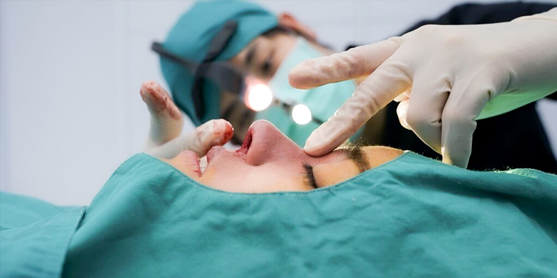 Is Rhinoplasty Dangerous? Who Should & Shouldn't Get Nose Plastic Surgery 2 is rhinoplasty dangerous
