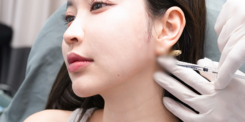 3 Non-Surgical Jaw Reduction Methods to Sculpt a V-Line at Keangnam Korea 3 Non-Surgical jaw reduction
