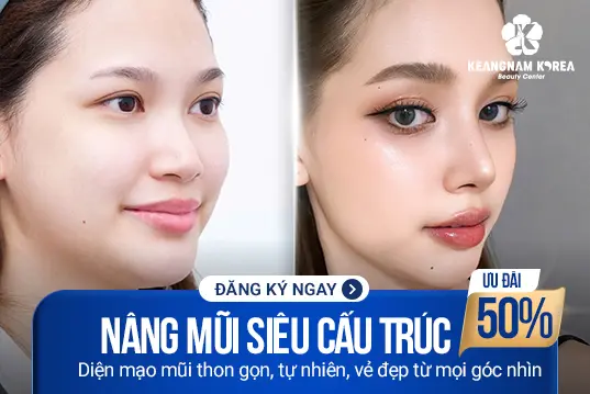 Nâng mũi siêu cấu trúc